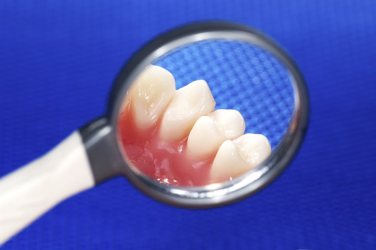 What Dental Conditions Is Amoxicillin Used For?