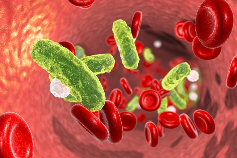 How Severe Is The Danger Of Sepsis From Dental Abscesses?