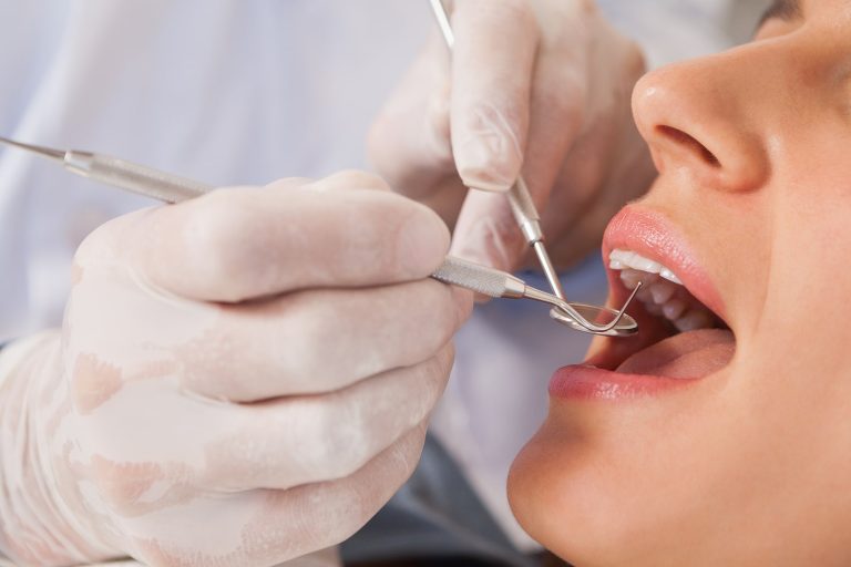 Do You Need To See A Dentist For Dental Abscess Antibiotics?