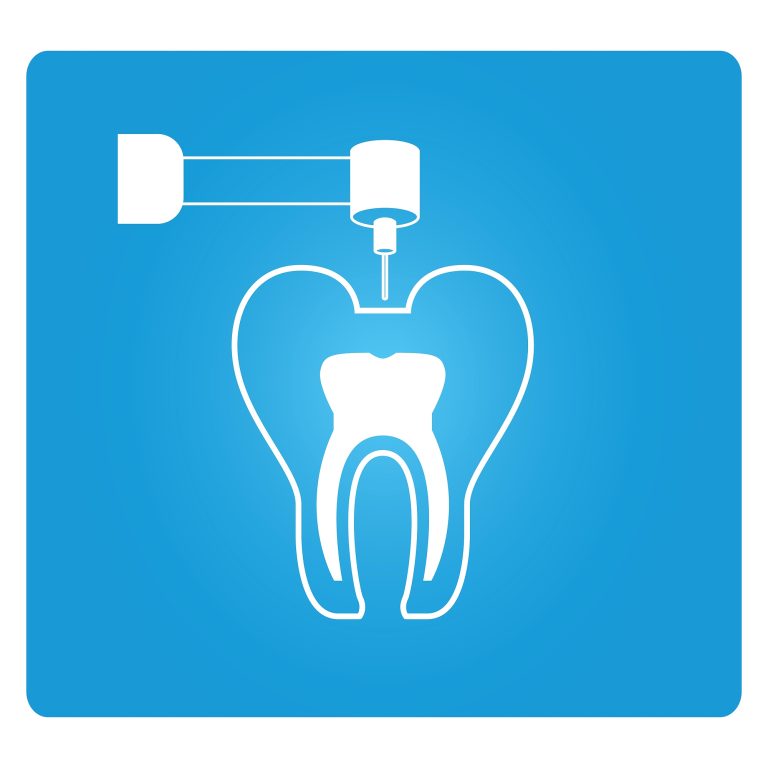 What Is Root Canal Treatment And When Would I Need It?