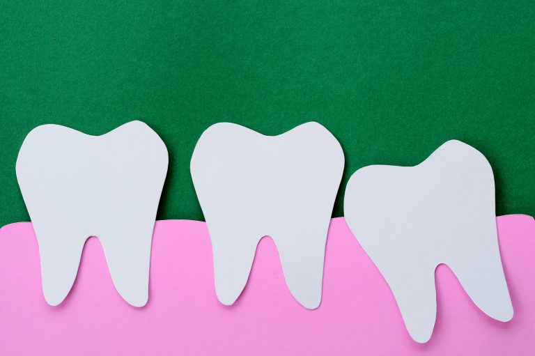 Wisdom Tooth Infections: When Do You Need Antibiotics?