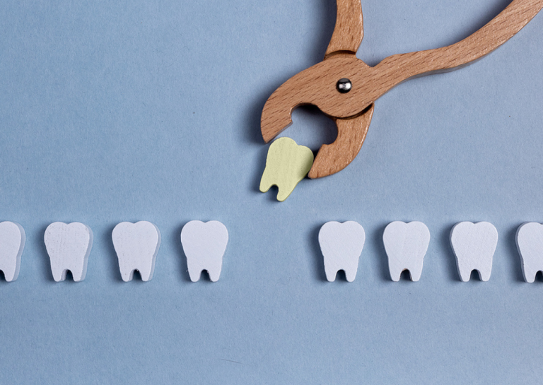 Is Root Canal Or Extraction Best For An Infected Tooth?